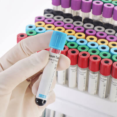 주문 Vacuum EDTA Blood Tubes for Complete Blood Count (CBC) – High Quality, Secure Seal 온라인 제품
