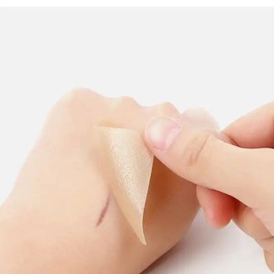 좋은 가격 실리콘 흉터 시트, 테이프, 스트립 - 치유 케로이드, 제사절, 배부 수술 - 수술 흉터 치료 온라인으로